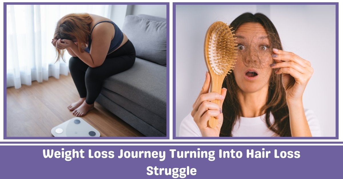 Weight Loss Journey Turning Into Hair Loss Struggles