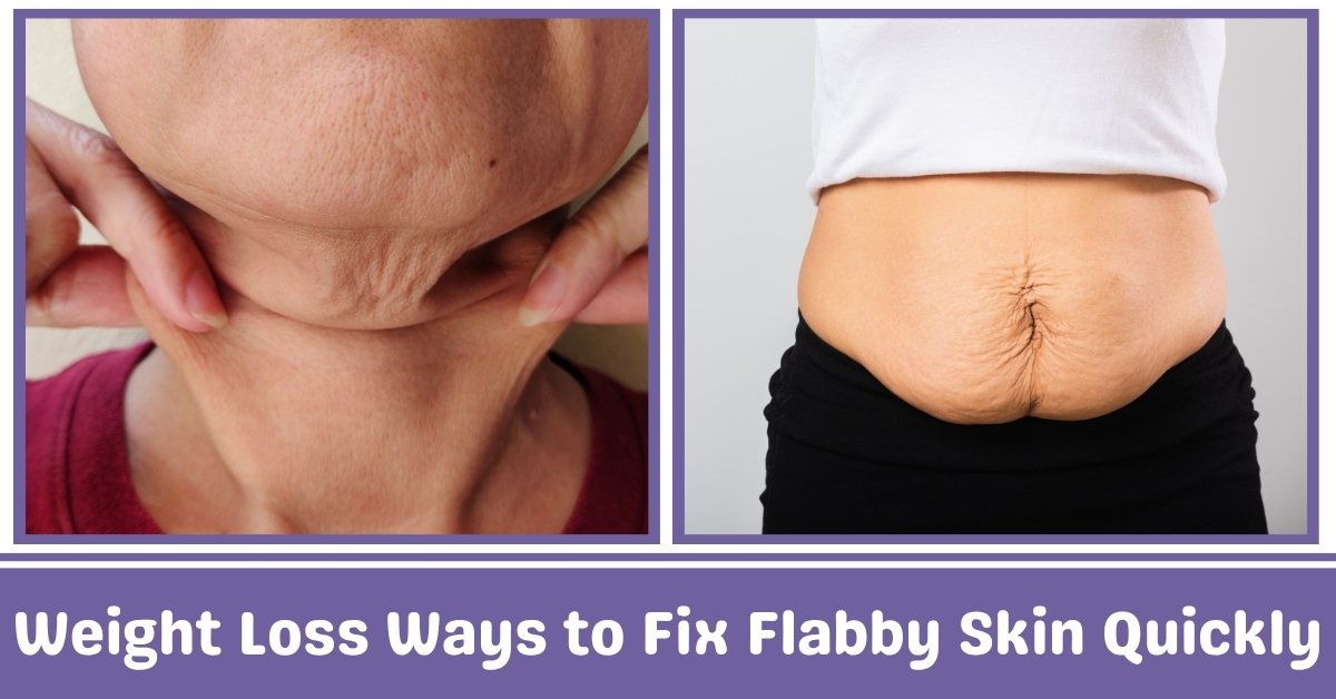 Weight Loss Ways to Fix Flabby Skins Quickly